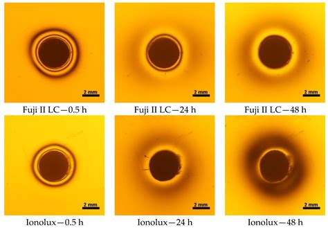 Contraction and Hydroscopic Expansion Stress of Dental Ion-Releasing ...