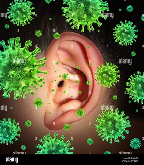 Outer ear infection hi-res stock photography and images - Alamy