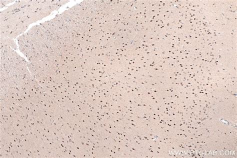 IHCeasy TSN Ready-To-Use IHC Kit KHC0903 | Proteintech