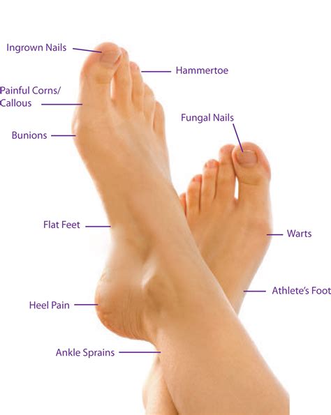 Foot (Anatomy): Bones, Ligaments, Muscles, Tendons, Arches The causes ...