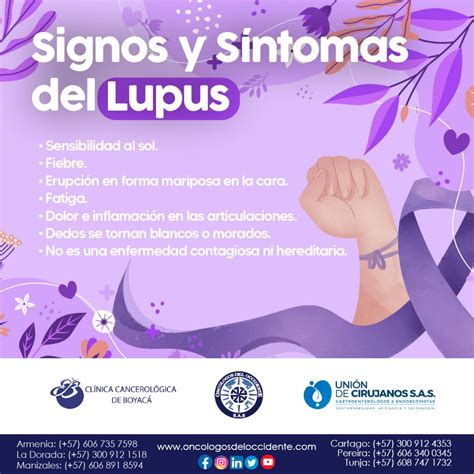 Lupus Es Cáncer
