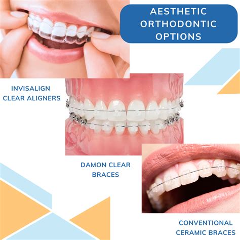 Damon Braces Vs Traditional