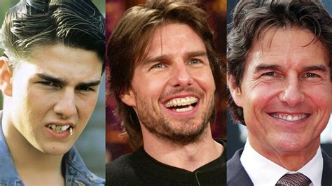 Tom Cruise's Teeth: The Evolution of the Hollywood Smile | İstanbul MosDent Dental Hospital