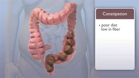 Image result for Flat Poop