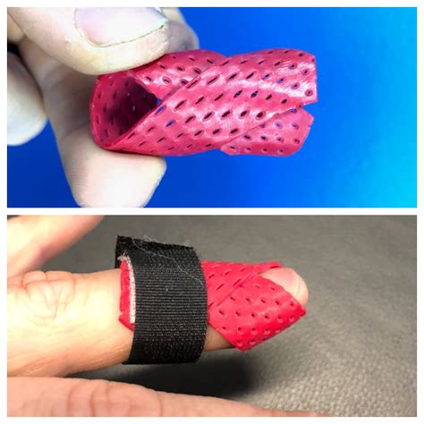 Homemade Splint for Trigger Finger 的图像结果