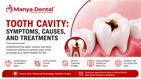 Tooth Cavity: Symptoms, Causes, and Treatments | Manya Dental | Manya ...