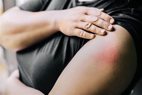 Image result for Injection Reactions