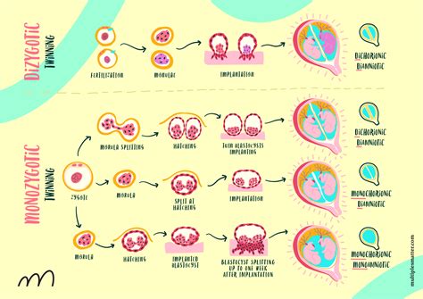 Types of Twin and Triplet Pregnancies
