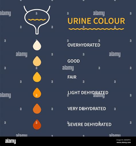awasome pregnancy urine color chart article clubcolor vgw what color ...