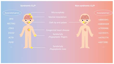 Genetic Inheritance Models of Non-Syndromic Cleft Lip with or without Palate: From Monogenic to ...