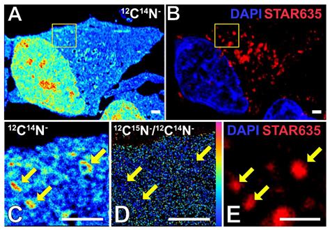Characterization of Stress Granule Protein Turnover in Neuronal ...