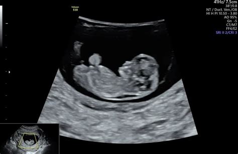 Image result for Alien 9 Design