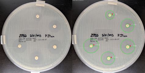 What Is a Kirby Bauer Test?