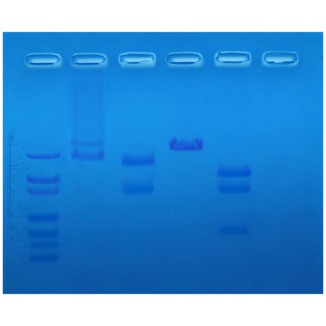 Image result for Restriction Enzyme Mapping