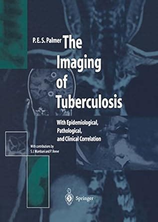 The Imaging of Tuberculosis: With Epidemiological, Pathological, and ...