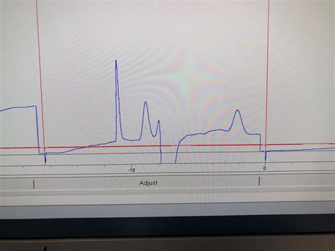 Image result for Poor Peak Resolution HPLC