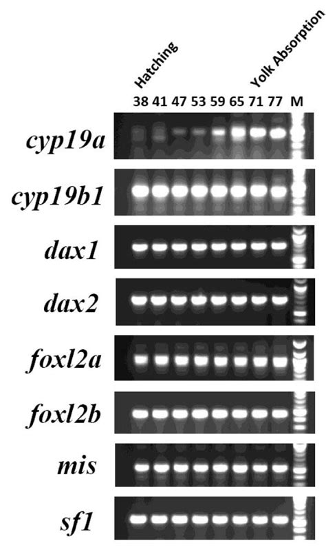 Image result for Reverse Transcriptase PCR