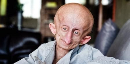 Fallece Beandri Booysen a los 19 años, la joven influencer que inspiró ...