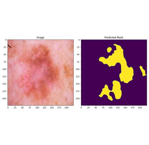 Image Segmentation Using Unet Tensorflow 的图像结果