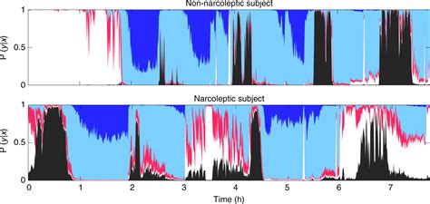 Narcolepsy Sleep Cycle Graph 的图像结果