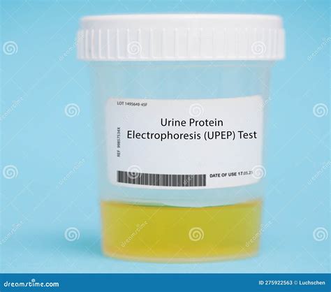 Urine Protein Electrophoresis (UPEP) Test Stock Image - Image of used, amyloidosis: 275922563