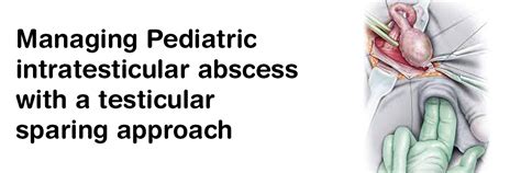 Managing Pediatric intratesticular abscess with a testicular sparing ...