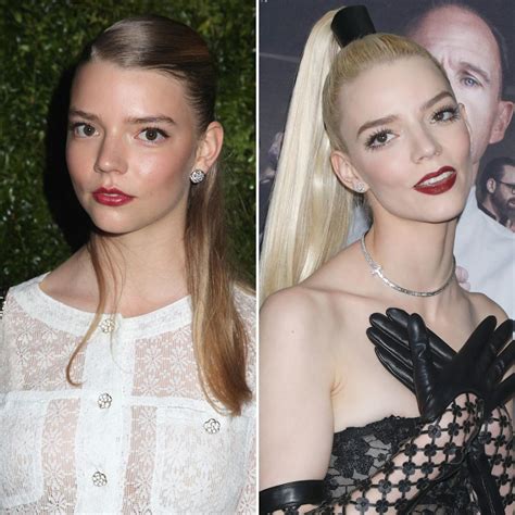 Did Anya Taylor-Joy Get Plastic Surgery? See Photos of the Actress’ Transformation Over the Years