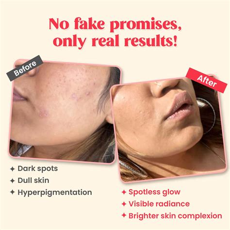 Buy CHICNUTRIX OUTSHINE-SKIN GLOW SERUM WITH VITAMIN C, GLUTATHIONE ...