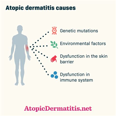 What Causes Atopic Dermatitis or Eczema?