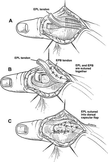 Image result for Examples of 6O2