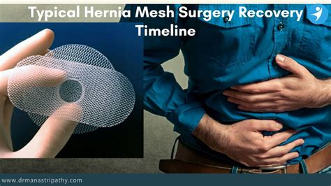 Hernia Surgery Recovery Time