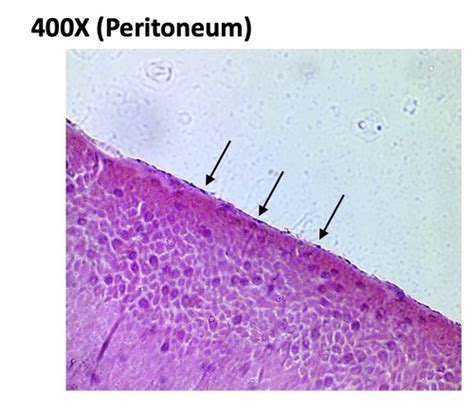 Image result for Ephilehal Tissue Sample