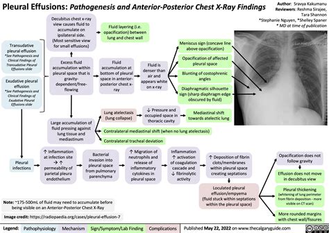 pleural-effusions-pathogenesis-and-anterior-posterior-chest-x-ray-findings | Calgary ...