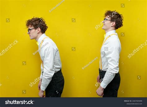 Hunchback Using a Computer 的图像结果