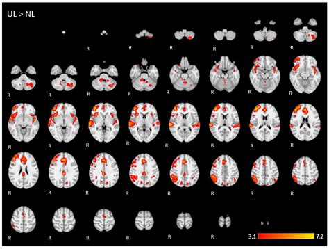 Engagement of Language and Domain General Networks during Word ...