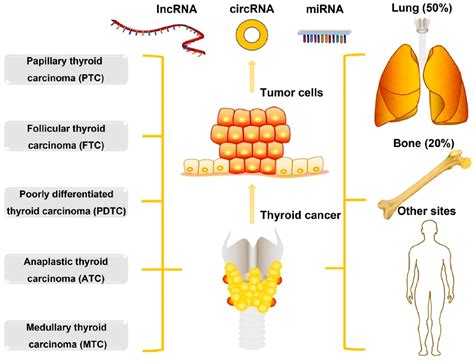 Is Thyroid Cancer Hereditary
