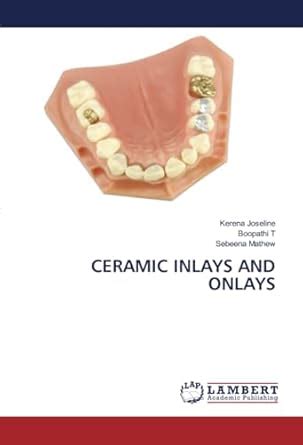 CERAMIC INLAYS AND ONLAYS : Amazon.in: Books