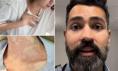 Heartburn could be sign of a 'hidden' condition - if you don't get ...