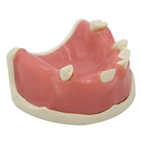 Buy WERYU Body Model Teeth Study Teaching Model,Oral Mandibular Models ...