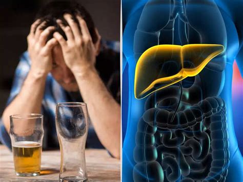 Early signs of liver damage from excessive drinking | The Times of India