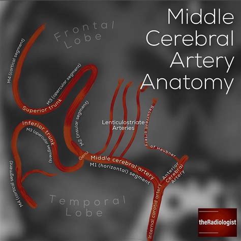 Anterior Cerebral Artery