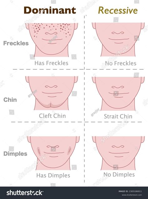 Es Un Mentón Hendido Dominante