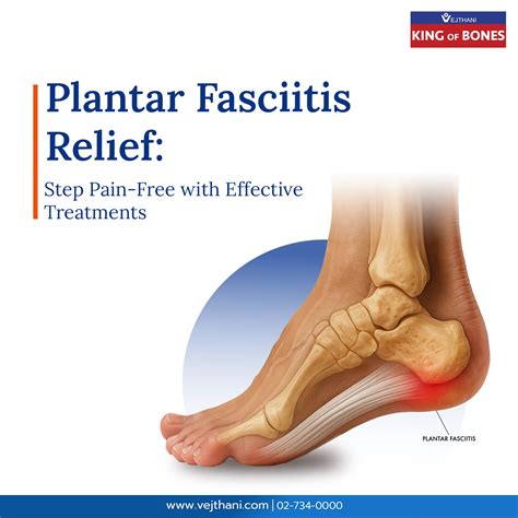Effective Plantar Fasciitis Treatment Options In Bangkok - Vejthani International Hospital | JCI ...