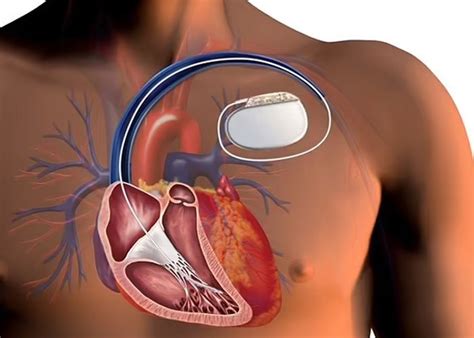 Best Cardiology Hospital