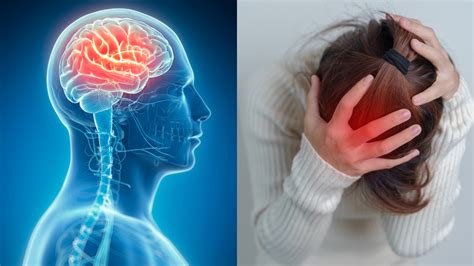 Brain Injury Recovery Tips: Rewiring the Brain for Recovery After ...