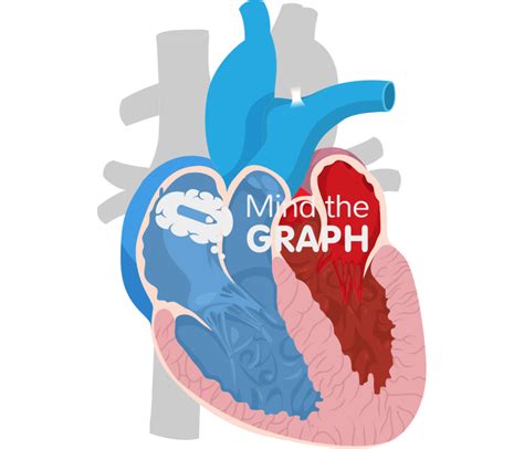 Image result for Graph Abstract Heart Development