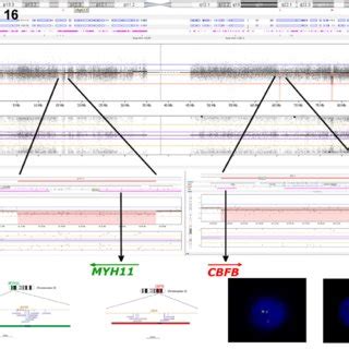 Image result for Copy Number Variation by SNP Array