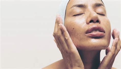 7 Foods You Should Eat To Prevent Oily Skin Naturally - lifeberrys.com