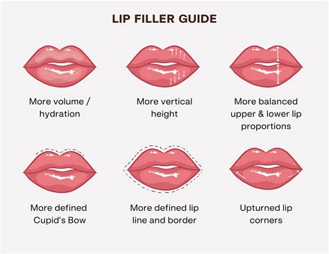 Lip fillers: your guide to a perfect pout | U Med Spa Plano & Frisco