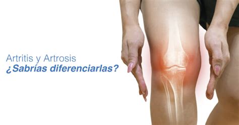 Image result for Autobester Blog